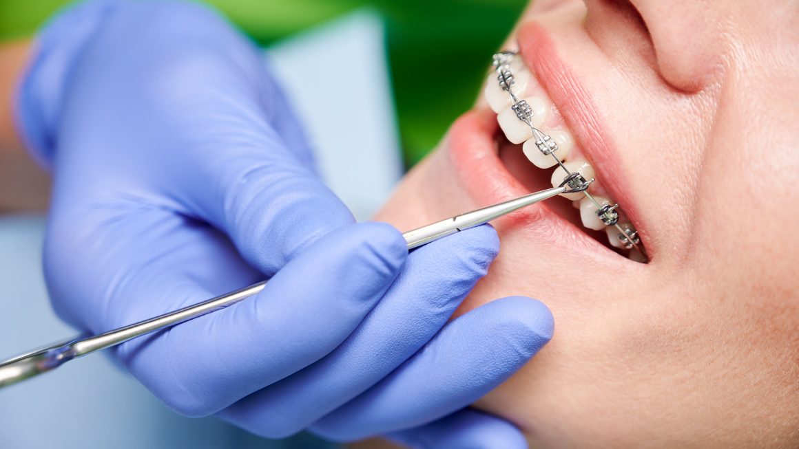 Studio Dentistico Malandrino - Ortodonzia Ortodonzia